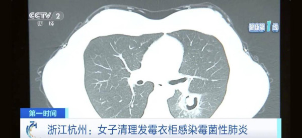 墻面發(fā)霉致癌？電滲脈沖技術(shù)‘抽干’墻體水分，30年不發(fā)霉